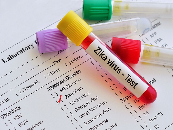 zika virus test